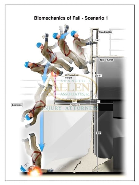 Medical Graphics – Personal Injury Medical Illustrations | Allen Law Group